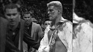 WWE zveřejnila záběry zakrváceného Codyho Rhodese po skončení vysílání SmackDownu