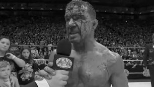 Chad Gable odhalil svou tvář po krvavé prohře v zápase Mask vs. Mask