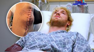 Logan Paul se ostře ohradil proti lidem, kteří se radují z jeho zranění