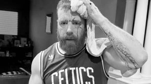 Sheamus utrpěl ošklivé zranění hlavy při bizarní nehodě v posilovně