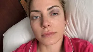Alexa Bliss má po nešťastné nehodě monokl