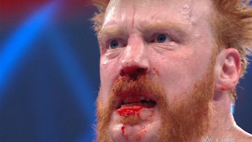 Sheamus