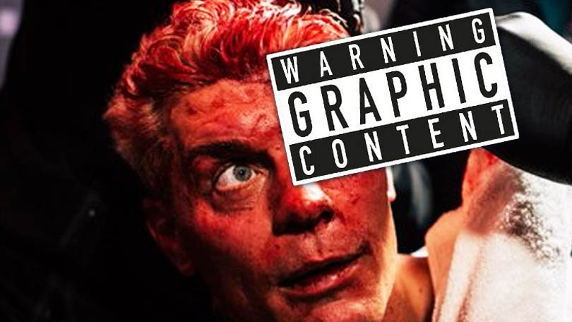 Cody Rhodes zveřejnil děsivé fotografie svého zranění ze zákulisí po WrestleManii 42