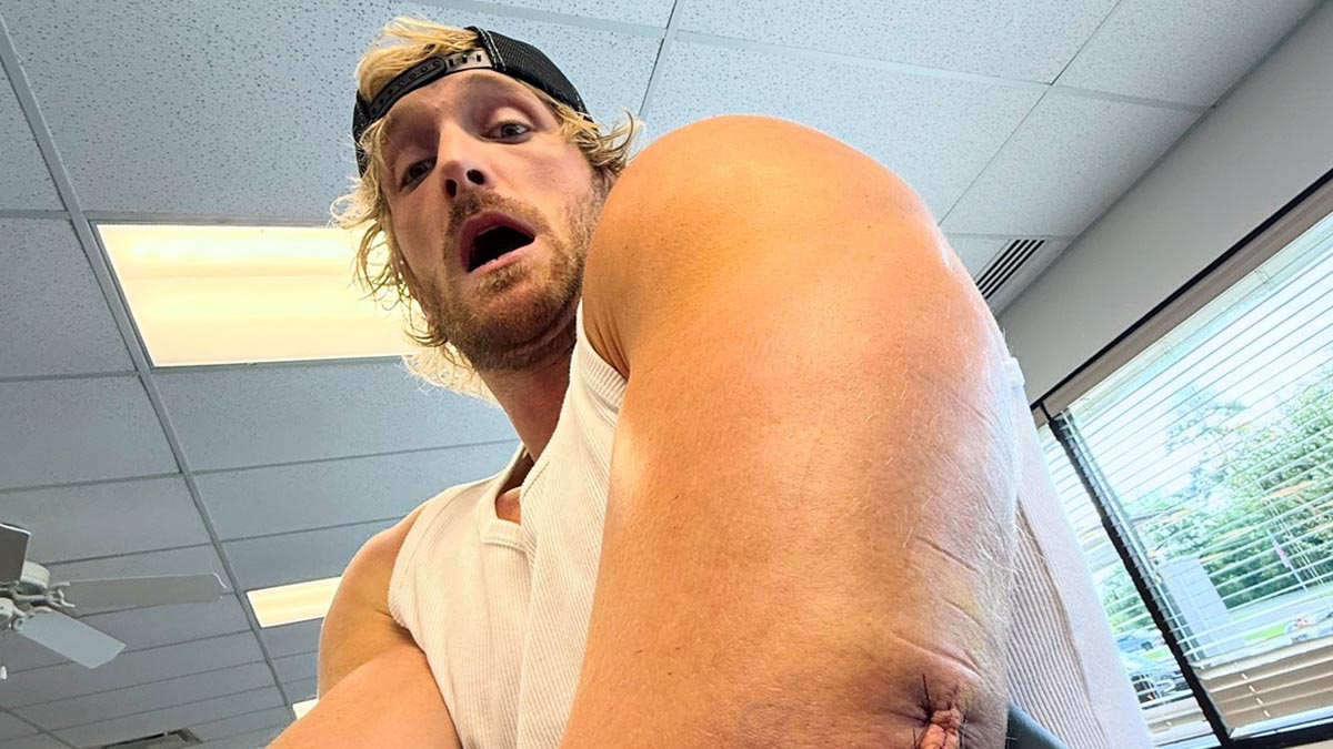 Logan Paul podstoupil operaci natrženého tricepsu. Jak dlouho bude mimo ring?