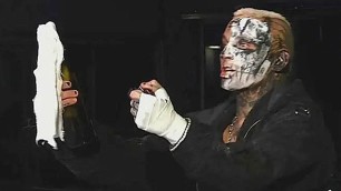 Darby Allin